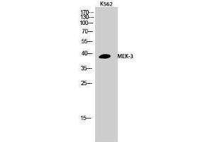 Western Blotting (WB) image for anti-Mitogen-Activated Protein Kinase Kinase 3 (MAP2K3) (Thr383) antibody (ABIN3185527) (MAP2K3 anticorps  (Thr383))