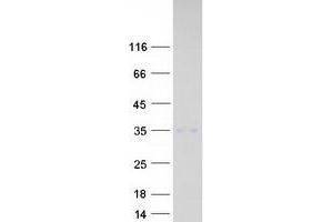Validation with Western Blot