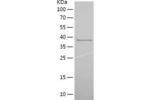 Western Blotting (WB) image for Microtubule-Associated Protein 2 (MAP2) (AA 1-226) protein (His tag) (ABIN7123963)