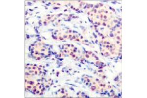 Image no. 2 for anti-Jun D Proto-Oncogene (JUND) (Ser255) antibody (ABIN197142)
