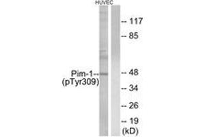 Western blot analysis of extracts from HuvEc cells treated with PMA 125ng/ml 30', using Pim-1 (Phospho-Tyr309) Antibody. (PIM1 anticorps  (pTyr309))
