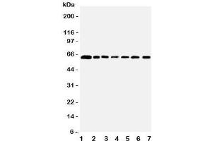 Western blot testing of PRMT4 antibody and Lane 1:  rat spleen;  2: human placenta;  3: (r) kidney;  4: mouse NIH3T3;  5: (h) HeLa;  6: (h) HL60;  7: (h) Jurkat lysate (CARM1 anticorps  (Middle Region))