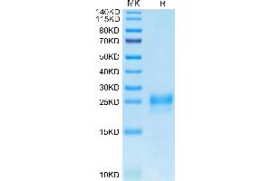 Human VEGF-C/Flt4-L on Tris-Bis PAGE under reduced condition. (VEGFC Protein (AA 103-227) (His-Avi Tag))