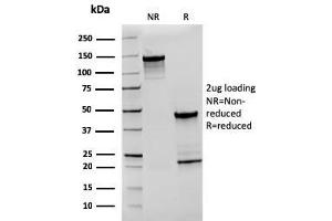 anti-CD27 Molecule (CD27) antibody