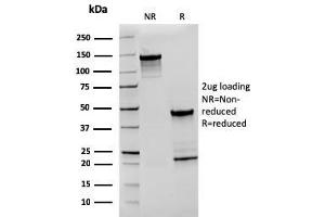 SDS-PAGE Analysis Purified CD27 Recombinant Mouse Monoclonal Antibody (rLPFS2/1611). (Recombinant CD27 anticorps)