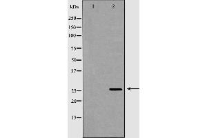Western blot analysis of Hela whole cell lysates, using GSTM2 Antibody. (GSTM2 anticorps  (C-Term))