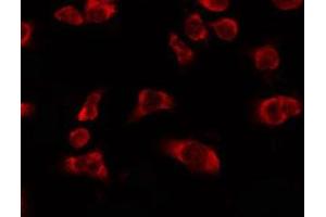ABIN6278614 staining HeLa by IF/ICC. (OR5H6 anticorps  (Internal Region))