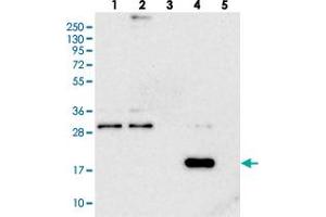 Western blot analysis of Lane 1: RT-4, Lane 2: U-251 MG, Lane 3: Human Plasma, Lane 4: Liver, Lane 5: Tonsil with RWDD4A polyclonal antibody . (RWDD4A anticorps)