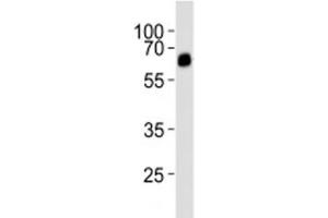 Western blot analysis of lysate from rat uterus tissue lysate using ALK3 antibody diluted at 1:1000.