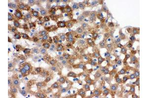 Immunohistochemistry (Paraffin-embedded Sections) (IHC (p)) image for anti-TF (AA 20-49), (N-Term) antibody (ABIN3043419) (TF (AA 20-49), (N-Term) anticorps)