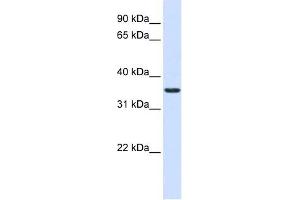 TXNDC14 antibody used at 1 ug/ml to detect target protein. (TMX2 anticorps  (Middle Region))