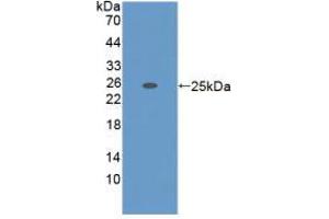 Western blot analysis of recombinant Mouse ADAMTS7.