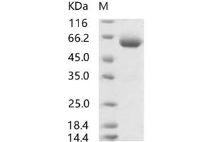 Western Blotting (WB) image for SARS-Coronavirus Spike Protein (SARS-CoV S) (RBD) protein (mFc Tag) (ABIN7197789)