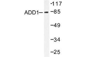 Image no. 2 for anti-Adducin 1 (Alpha) (ADD1) antibody (ABIN265301) (alpha Adducin anticorps)
