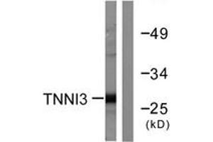 Western blot analysis of extracts from mouse heart cells, using TNNI3 (Ab-22/23) Antibody. (TNNI3 anticorps  (AA 5-54))