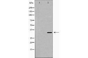 Western blot analysis of HO-1 expression in fetal liver lysate. (HMOX1 anticorps  (Internal Region))