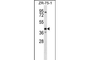 KCNK1 Antibody (C-term) (ABIN656655 and ABIN2845896) western blot analysis in ZR-75-1 cell line lysates (35 μg/lane). (KCNK1 anticorps  (C-Term))