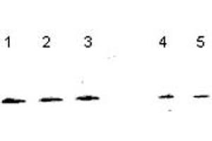 Western blot analysis of NUDT1 in NT2 cells (Lanes 1-3), and 833K64Cp9 cells (Lanes 4-5) with NUDT1 polyclonal antibody . (NUDT1 anticorps  (C-Term))