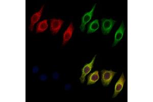 ABIN6259482 and ABIN6275755 staining Hela cells by IF/ICC. (STARD10 anticorps  (Internal Region))