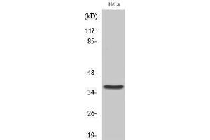 Western Blotting (WB) image for anti-Cysteinyl Leukotriene Receptor 2 (CYSLTR2) (C-Term) antibody (ABIN3184211) (CasLTR2 anticorps  (C-Term))