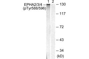 Western blot analysis of extracts from HepG2 cells, using EPHA2/3/4 (Phospho-Tyr588/596) antibody. (EPHA2/3 anticorps  (pTyr588, pTyr596))
