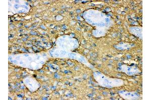 Anti- Aquaporin 4 Picoband antibody, IHC(P) IHC(P): Human Glioma Tissue