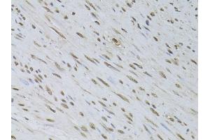 Immunohistochemistry of paraffin-embedded rat testis using HDGFRP3 Rabbit pAb (ABIN6133452, ABIN6141699, ABIN6141700 and ABIN6224799) at dilution of 1:150 (40x lens). (HDGFRP3 anticorps  (AA 90-203))