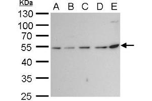 WB Image beta Tubulin 2 antibody detects beta Tubulin 2 protein by western blot analysis. (TUBB2A anticorps)