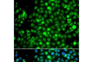 Immunofluorescence analysis of A549 cells using NME2 Polyclonal Antibody (NME2 anticorps)
