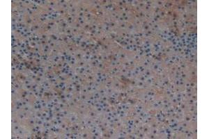 IHC-P analysis of Rat Adrenal Gland Tissue, with DAB staining. (TXNRD1 anticorps  (AA 208-433))