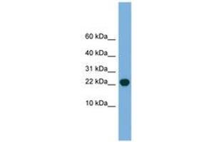 Image no. 1 for anti-Processing of Precursor 5, Ribonuclease P/MRP Subunit (POP5) (C-Term) antibody (ABIN6745124)
