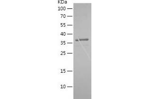 Western Blotting (WB) image for Cancer/testis Antigen 1B (CTAG1B) (AA 1-146) protein (His-IF2DI Tag) (ABIN7122116) (CTAG1B Protein (AA 1-146) (His-IF2DI Tag))