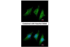ICC/IF Image Immunofluorescence analysis of methanol-fixed HeLa, using CD55, antibody at 1:200 dilution. (CD55 anticorps  (Center))