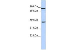 Western Blotting (WB) image for anti-DEAH (Asp-Glu-Ala-His) Box Polypeptide 35 (DHX35) antibody (ABIN2458247) (DHX35 anticorps)