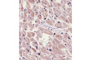 (ABIN6242529 and ABIN6578789) staining PKN1 in human heart tissue sections by Immunohistochemistry (IHC-P - paraformaldehyde-fixed, paraffin-embedded sections).