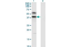 Western Blot analysis of ART3 expression in transfected 293T cell line by ART3 monoclonal antibody (M09), clone 1D2.