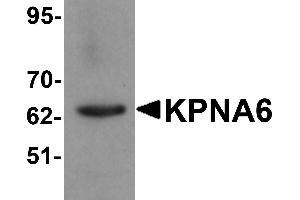 Western blot analysis of KPNA6 in 293 cell lysate with KPNA6 antibody at 1 µg/mL. (KPNA6 anticorps  (N-Term))