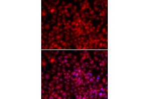 Immunofluorescence analysis of U2OS cells using ILF2 antibody. (ILF2 anticorps)