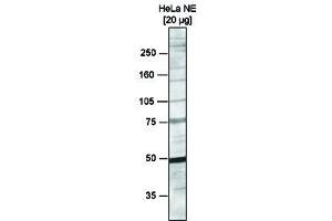 anti-RbAp46/48 antibody