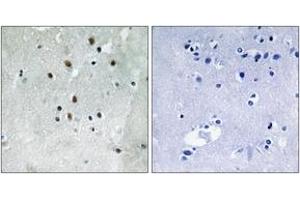 Immunohistochemistry analysis of paraffin-embedded human brain, using SRF (Phospho-Ser77) Antibody. (SRF anticorps  (pSer77))