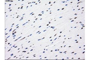 Immunohistochemical staining of paraffin-embedded liver tissue using anti-LOXmouse monoclonal antibody. (LOX anticorps  (AA 22-168))