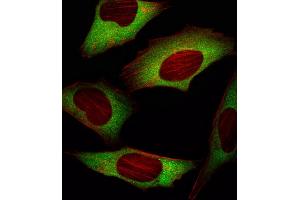 Fluorescent image of Hela cell stained with EIF4E Antibody (ABIN659032 and ABIN2838050)/SG101020AF. (EIF4E anticorps)