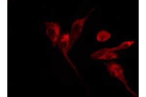 ABIN6269091 staining HepG2 by IF/ICC. (Integrin beta 3 anticorps  (C-Term))
