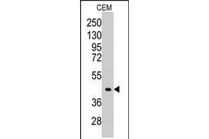 Western blot analysis of ALDOC polyclonal antibody  in CEM cell line lysates (35 ug/lane). (ALDOC anticorps  (C-Term))