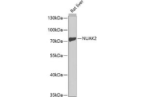 Western blot analysis of extracts of rat liver, using NU antibody (ABIN3021382, ABIN3021383, ABIN3021384 and ABIN6214981) at 1:1000 dilution. (NUAK2 anticorps  (AA 523-672))