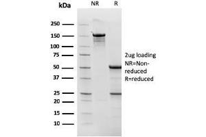 SDS-PAGE Analysis Purified Topo I, MT Mouse Monoclonal Antibody (TOP1MT/568). (TOP1MT anticorps)