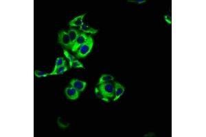 Immunofluorescence staining of PC-3 cells with ABIN7143505 at 1:100, counter-stained with DAPI.