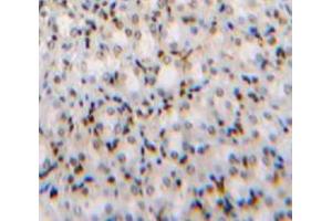 Used in DAB staining on fromalin fixed paraffin-embedded Kidney tissue (TCF20 anticorps  (AA 1656-1792))