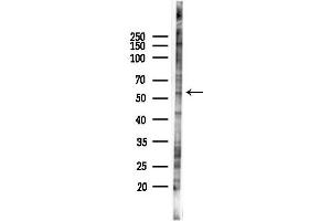 anti-Zinc Finger Protein 683 (ZNF683) antibody
