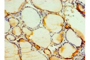 Immunohistochemistry of paraffin-embedded human thyroid tissue using ABIN7146163 at dilution of 1:100 (C3AR1 anticorps  (AA 160-340))
